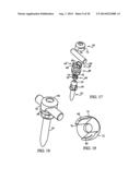 Polyaxial Screw diagram and image