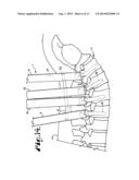 BONE ANCHOR CONFIGURED TO ANCHOR AN ELONGATED IMPLANT TO A PATIENT BONE diagram and image