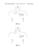 SYSTEMS AND METHODS FOR AVOIDING NEURAL STIMULATION HABITUATION diagram and image