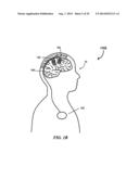 SYSTEMS AND METHODS FOR ENHANCING OR AFFECTING NEURAL STIMULATION     EFFICIENCY AND/OR EFFICACY diagram and image