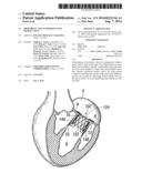 PROSTHETIC VALVE FOR REPLACING MITRAL VALVE diagram and image