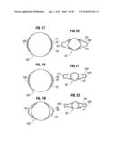 PROSTHETIC VALVE FOR REPLACING MITRAL VALVE diagram and image