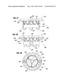 PROSTHETIC VALVE FOR REPLACING MITRAL VALVE diagram and image