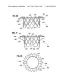 PROSTHETIC VALVE FOR REPLACING MITRAL VALVE diagram and image