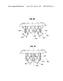 PROSTHETIC VALVE FOR REPLACING MITRAL VALVE diagram and image