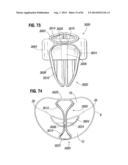 PROSTHETIC VALVE FOR REPLACING MITRAL VALVE diagram and image