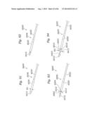 PROSTHETIC VALVE FOR REPLACING MITRAL VALVE diagram and image