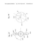 PROSTHETIC VALVE FOR REPLACING MITRAL VALVE diagram and image