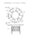 PROSTHETIC VALVE FOR REPLACING MITRAL VALVE diagram and image