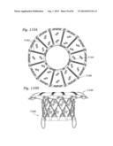 PROSTHETIC VALVE FOR REPLACING MITRAL VALVE diagram and image