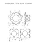 PROSTHETIC VALVE FOR REPLACING MITRAL VALVE diagram and image