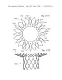 PROSTHETIC VALVE FOR REPLACING MITRAL VALVE diagram and image