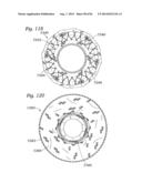 PROSTHETIC VALVE FOR REPLACING MITRAL VALVE diagram and image