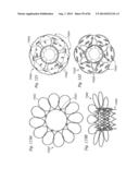 PROSTHETIC VALVE FOR REPLACING MITRAL VALVE diagram and image