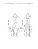 PROSTHETIC VALVE FOR REPLACING MITRAL VALVE diagram and image