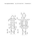 PROSTHETIC VALVE FOR REPLACING MITRAL VALVE diagram and image