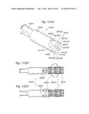 PROSTHETIC VALVE FOR REPLACING MITRAL VALVE diagram and image