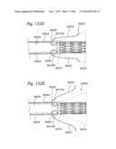 PROSTHETIC VALVE FOR REPLACING MITRAL VALVE diagram and image