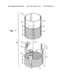 METHODS OF IMPLANTING MINIMALLY-INVASIVE PROSTHETIC HEART VALVES diagram and image