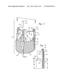 METHODS OF IMPLANTING MINIMALLY-INVASIVE PROSTHETIC HEART VALVES diagram and image