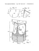 METHODS OF IMPLANTING MINIMALLY-INVASIVE PROSTHETIC HEART VALVES diagram and image