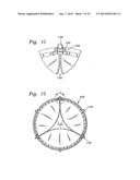 METHODS OF IMPLANTING MINIMALLY-INVASIVE PROSTHETIC HEART VALVES diagram and image