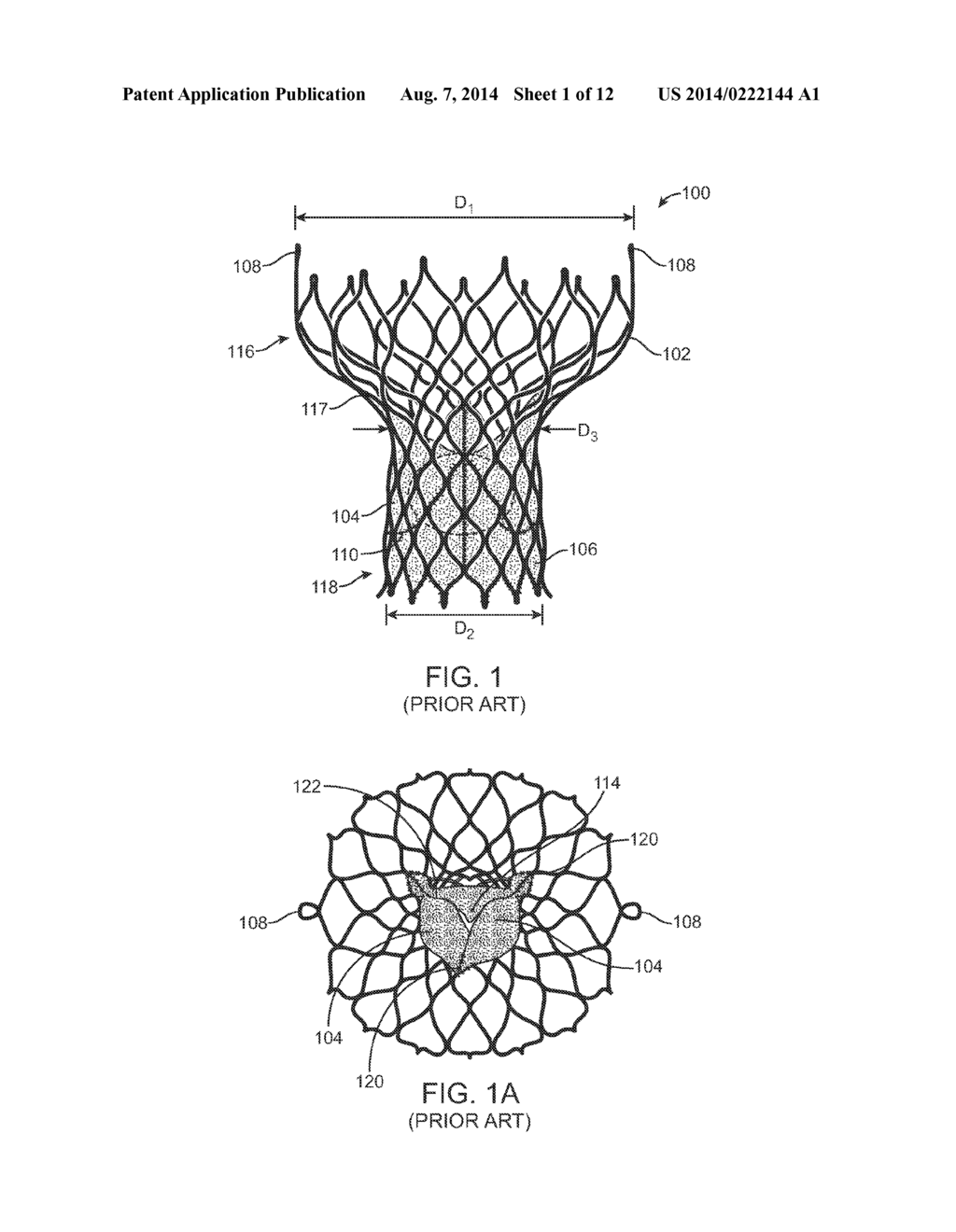 Anti-Paravalvular Leakage Component for a Transcatheter Valve Prosthesis - diagram, schematic, and image 02