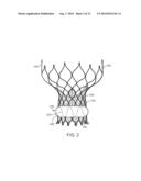 Anti-Paravalvular Leakage Component for a Transcatheter Valve Prosthesis diagram and image