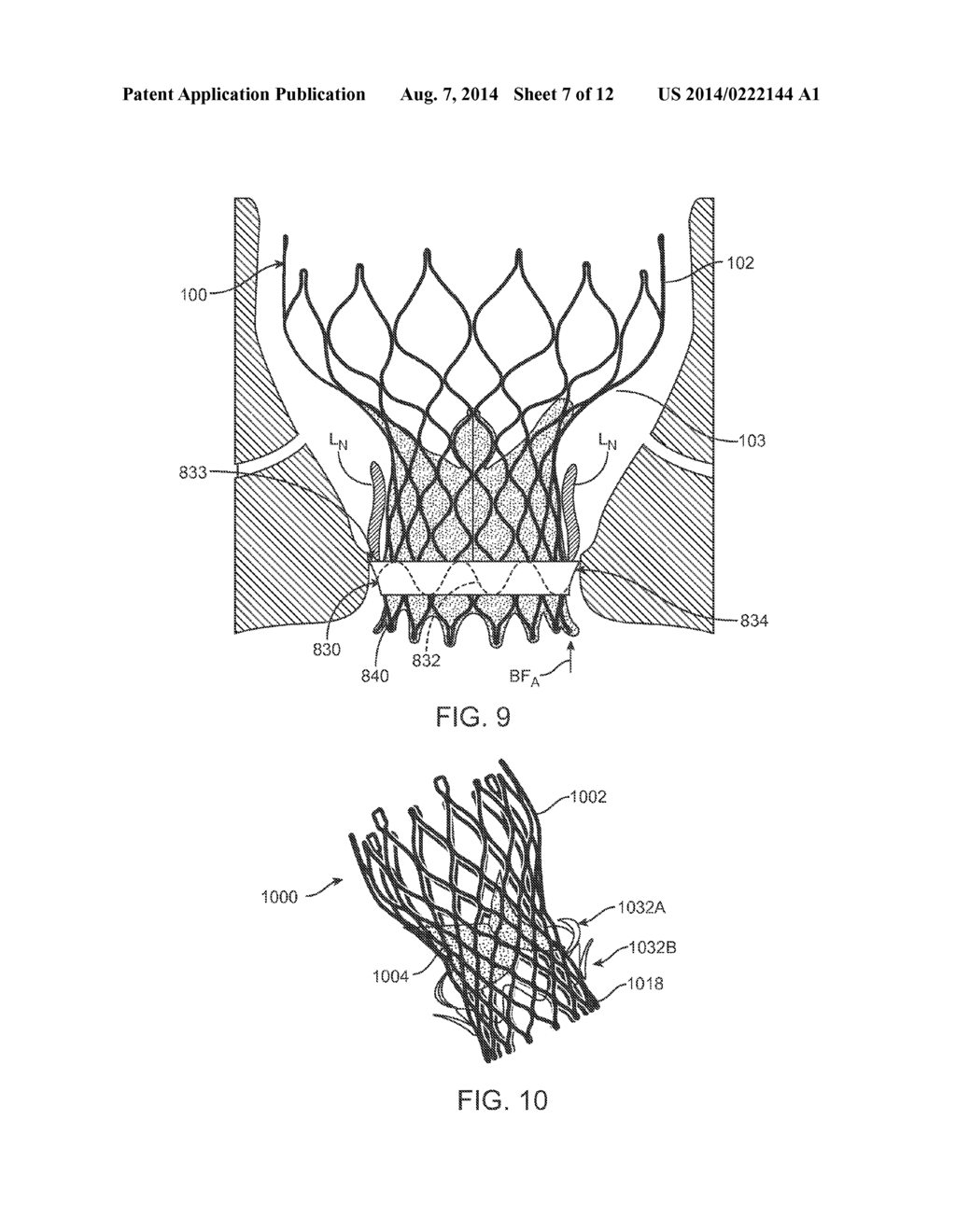 Anti-Paravalvular Leakage Component for a Transcatheter Valve Prosthesis - diagram, schematic, and image 08