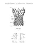 Anti-Paravalvular Leakage Component for a Transcatheter Valve Prosthesis diagram and image