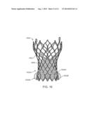 Anti-Paravalvular Leakage Component for a Transcatheter Valve Prosthesis diagram and image