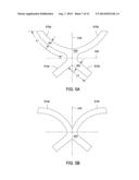 SYSTEMS AND METHODS FOR MASTOPEXY diagram and image