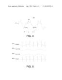 ELECTROCARDIOGRAM BASELINE REMOVAL diagram and image