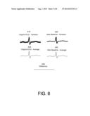 ELECTROCARDIOGRAM BASELINE REMOVAL diagram and image