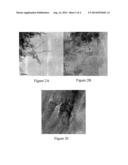 PRODUCTION OF CARBON NANOSTRUCTURES FROM FUNCTIONALIZED FULLERENES diagram and image