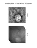 Methods and Apparatus for Retinal Imaging diagram and image