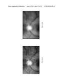 Methods and Apparatus for Retinal Imaging diagram and image