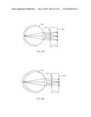 Methods and Apparatus for Retinal Imaging diagram and image