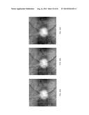 Methods and Apparatus for Retinal Imaging diagram and image