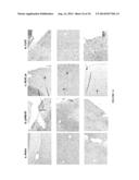 VACCINES FOR PREVENTING AND TREATING ALZHEIMER S DISEASE diagram and image