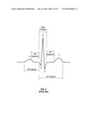 Two Electrode Apparatus and Methods for Twelve Lead ECG diagram and image