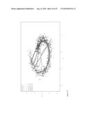 Method and System for Non-linear Quantification of Pathway Deregulation     for Analysis of Malignancies diagram and image