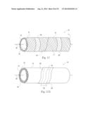 FIBROUS CORES diagram and image