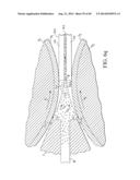 HEAT TREATABLE ALUMINUM ALLOYS HAVING MAGNESIUM AND ZINC AND METHODS FOR     PRODUCING THE SAME diagram and image