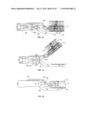 MULTI-FIRE STAPLING SYSTEMS diagram and image