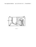 APPARATUS AND METHOD FOR FOUR DIMENSIONAL SOFT TISSUE NAVIGATION IN     ENDOSCOPIC APPLICATIONS diagram and image