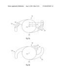 ARTICLE FOR USE IN AN OCT-METHOD AND INTRAOCULAR LENS diagram and image