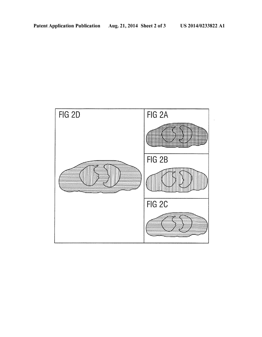 METHOD FOR COMBINING MULTIPLE IMAGE DATA SETS INTO ONE MULTI-FUSED IMAGE - diagram, schematic, and image 03