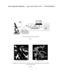 SYSTEMS AND METHODS FOR AUTOMATED SCREENING AND PROGNOSIS OF CANCER FROM     WHOLE-SLIDE BIOPSY IMAGES diagram and image