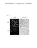 MICRODYSTROPHIN PEPTIDES AND METHODS FOR TREATING MUSCULAR DYSTROPHY USING     THE SAME diagram and image